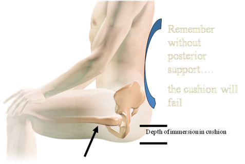 Remember without posterior support... the cushion will fail