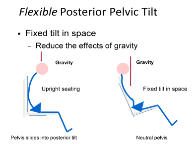 Flexible Posterior Pelvic Tilt. Fixed tilt in space. Reduce the effects of gravity. Upright seating: Pelvis slides into posterior tilt. Fixed tilt in space: Neutral pelvis.