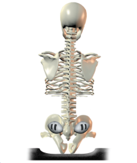 Posterior-lateral sacral support not present