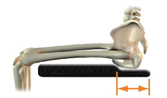 Pelvic contour length - too short