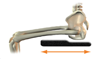 Femoral support length - too short