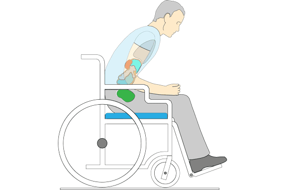 Illustration of a man slumped over in his wheelchair