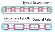 Increased sarcomere length, but reduction in number 2