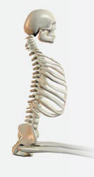 Anterior pelvic tilt with hyperlordosis skeletal diagram