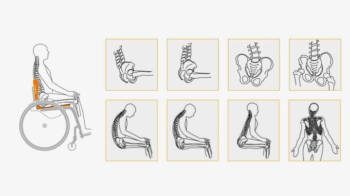 Pelvic & Spinal Postures